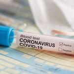 Sebaran Kasus Baru Virus Corona di Maluku Utara pada 3 Juni